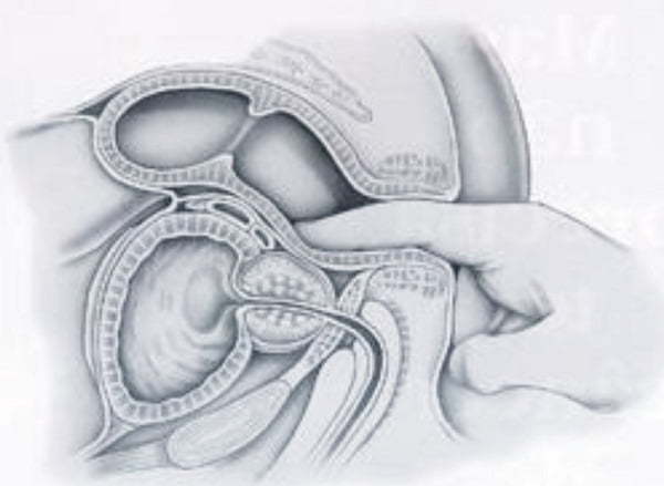 как делать массаж простаты пальцем